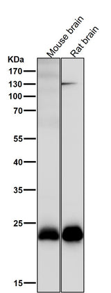 Anti-SNAP23 Rabbit Monoclonal Antibody Boster Bio