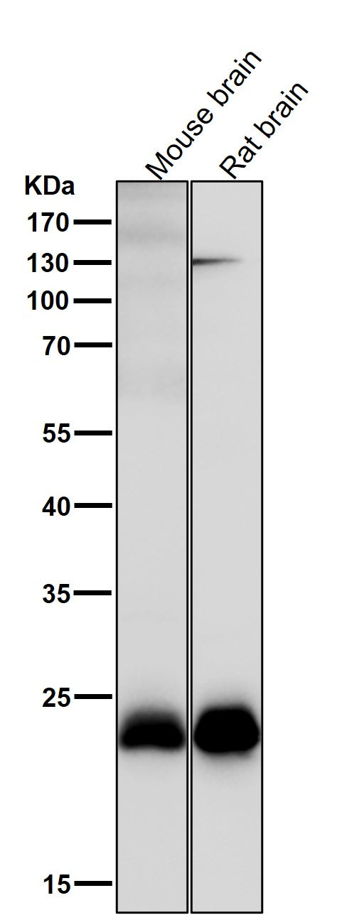 Anti-SNAP23 Rabbit Monoclonal Antibody Boster Bio
