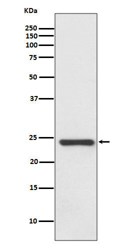 Anti-HSPB8/HSP22 Rabbit Monoclonal Antibody Boster Bio