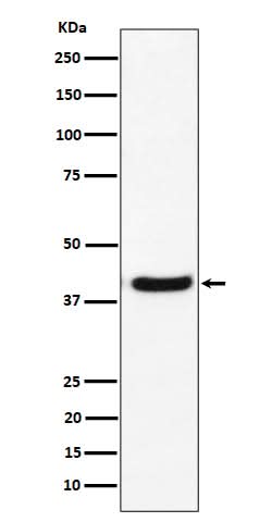 Anti-GNAI2 Rabbit Monoclonal Antibody Boster Bio