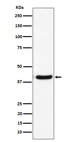 Anti-GNAI2 Rabbit Monoclonal Antibody Boster Bio