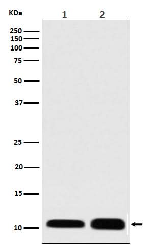 Anti-S100 S100A1 Rabbit Monoclonal Antibody Boster Bio