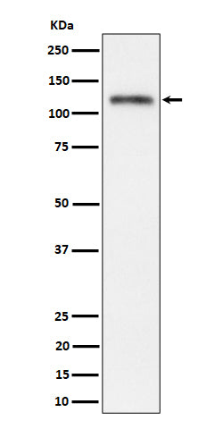 Anti-Semaphorin 4D / CD100 Rabbit Monoclonal Antibody Boster Bio