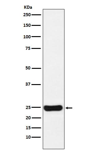 Anti-Cathepsin S CTSS Monoclonal Antibody Boster Bio
