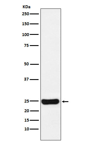 Anti-Cathepsin S CTSS Monoclonal Antibody Boster Bio