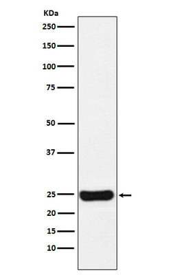Anti-Cathepsin S CTSS Monoclonal Antibody Boster Bio