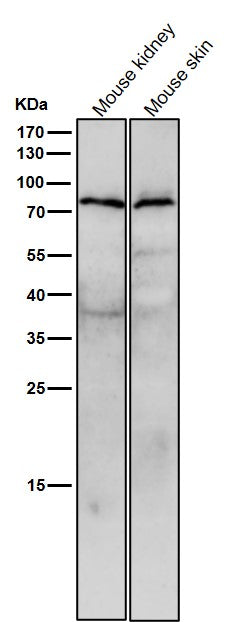 Anti-STK39 Rabbit Monoclonal Antibody Boster Bio