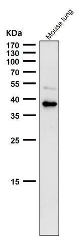 Anti-CXCR6 / CD186 Rabbit Monoclonal Antibody Boster Bio