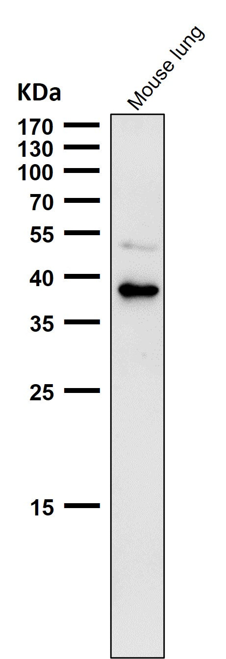 Anti-CXCR6 / CD186 Rabbit Monoclonal Antibody Boster Bio