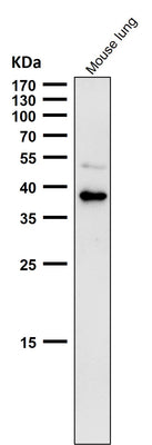 Anti-CXCR6 / CD186 Rabbit Monoclonal Antibody Boster Bio