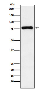 Anti-RNase L Rabbit Monoclonal Antibody Boster Bio