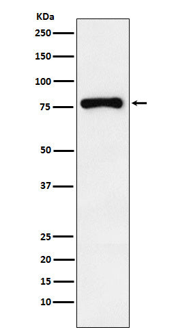 Anti-RNase L Rabbit Monoclonal Antibody Boster Bio