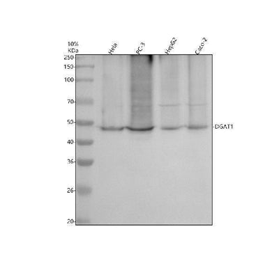 Anti-DGAT1 Rabbit Monoclonal Antibody Boster Bio
