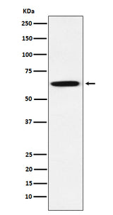 Anti-GRB7 Rabbit Monoclonal Antibody Boster Bio