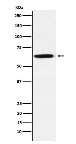 Anti-GRB7 Rabbit Monoclonal Antibody Boster Bio