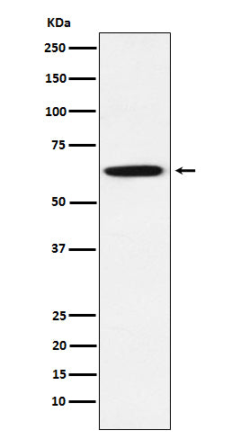 Anti-GRB7 Rabbit Monoclonal Antibody Boster Bio