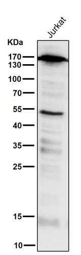Anti-PELP1 Rabbit Monoclonal Antibody Boster Bio