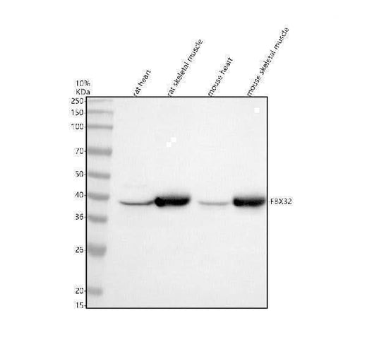 Anti-Fbx32 Rabbit Monoclonal Antibody Boster Bio