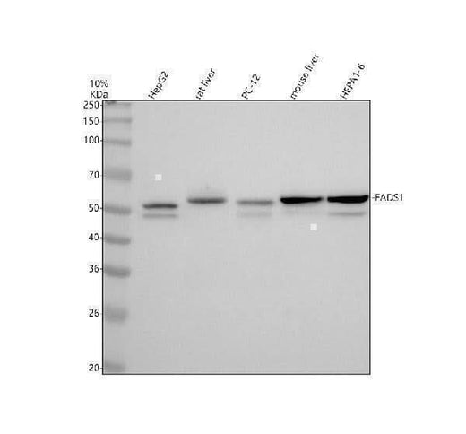 Anti-FADS1 Rabbit Monoclonal Antibody Boster Bio