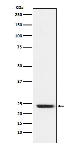 Anti-FNDC5 Rabbit Monoclonal Antibody Boster Bio