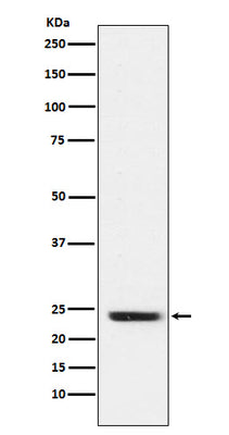 Anti-FNDC5 Rabbit Monoclonal Antibody Boster Bio