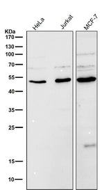 Anti-LOXL2 Rabbit Monoclonal Antibody Boster Bio