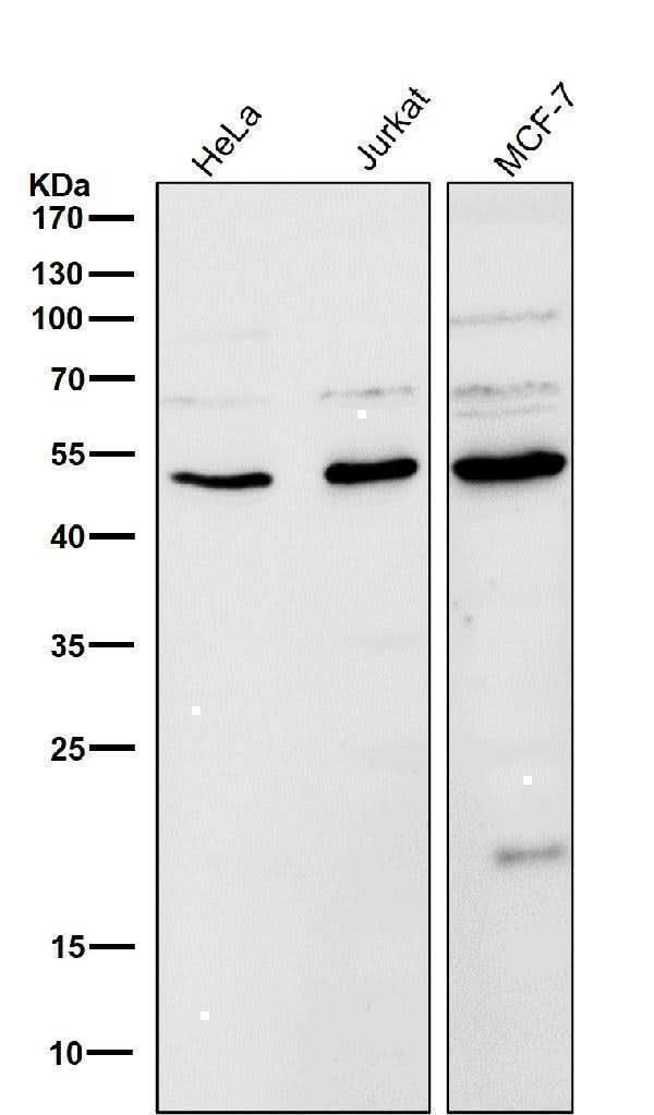 Anti-LOXL2 Rabbit Monoclonal Antibody Boster Bio
