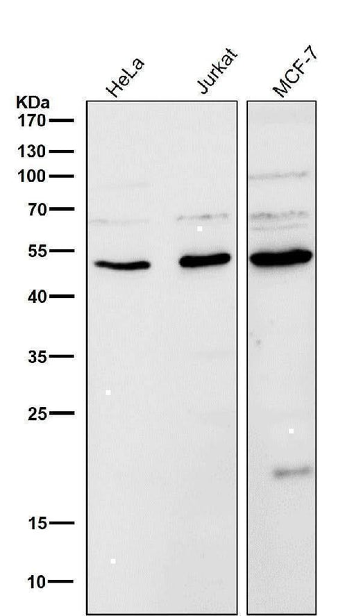 Anti-LOXL2 Rabbit Monoclonal Antibody Boster Bio