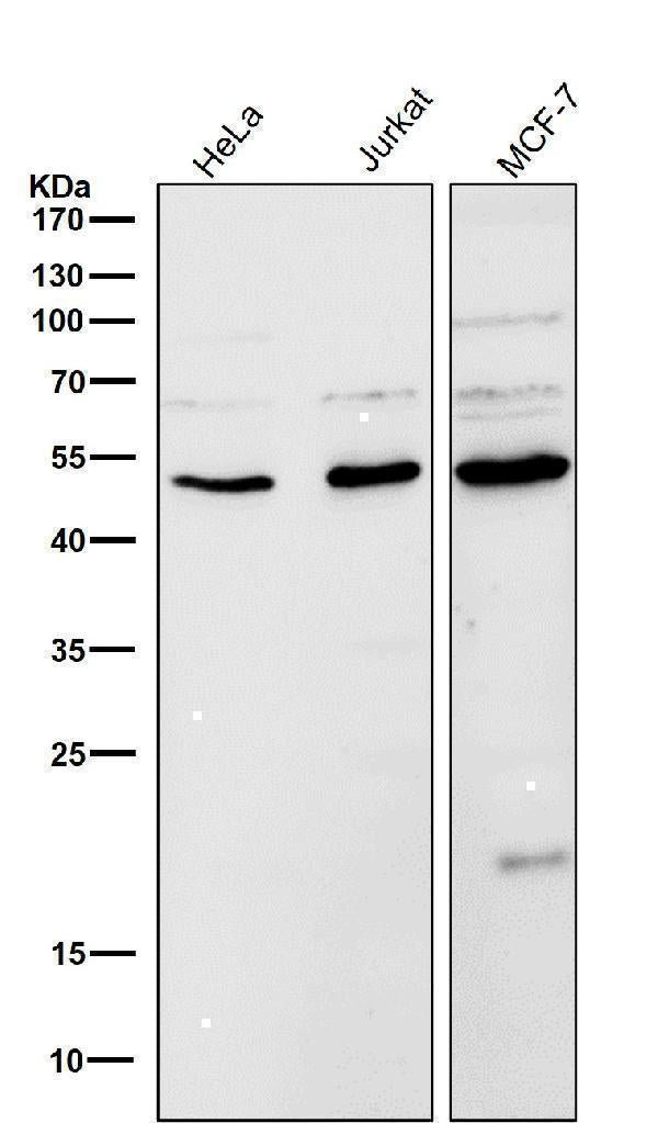 Anti-LOXL2 Rabbit Monoclonal Antibody Boster Bio