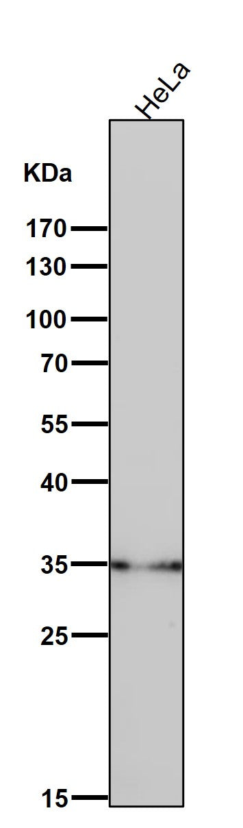 Anti-LDHB Rabbit Monoclonal Antibody Boster Bio