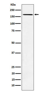 Anti-AGL Rabbit Monoclonal Antibody Boster Bio