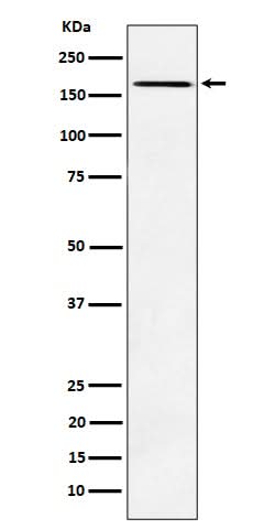 Anti-AGL Rabbit Monoclonal Antibody Boster Bio