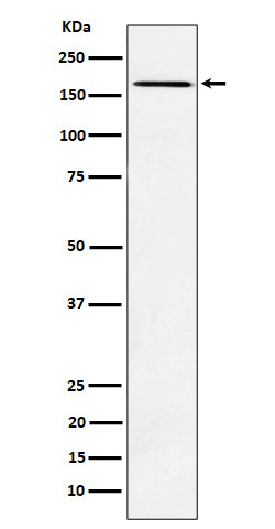 Anti-AGL Rabbit Monoclonal Antibody Boster Bio