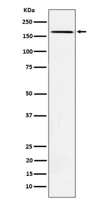 Anti-AGL Rabbit Monoclonal Antibody Boster Bio