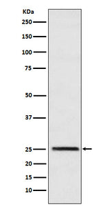 Anti-Triosephosphate isomerase Rabbit Monoclonal Antibody Boster Bio