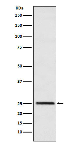 Anti-Triosephosphate isomerase Rabbit Monoclonal Antibody Boster Bio