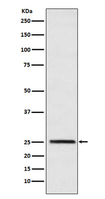 Anti-Triosephosphate isomerase Rabbit Monoclonal Antibody Boster Bio