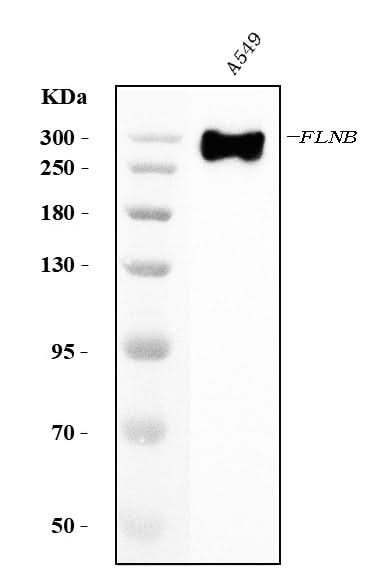 Anti-Filamin B/FLNB Antibody Picoband® (monoclonal, 11E2D2 Boster Bio