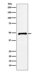Anti-CTBP2 Rabbit Monoclonal Antibody Boster Bio