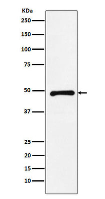 Anti-CTBP2 Rabbit Monoclonal Antibody Boster Bio