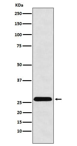 Anti-HLA-DRB4 Rabbit Monoclonal Antibody Boster Bio
