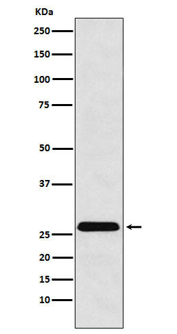 Anti-HLA-DRB4 Rabbit Monoclonal Antibody Boster Bio