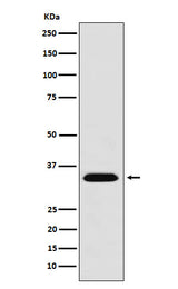 Anti-MBD3 Monoclonal Antibody Boster Bio