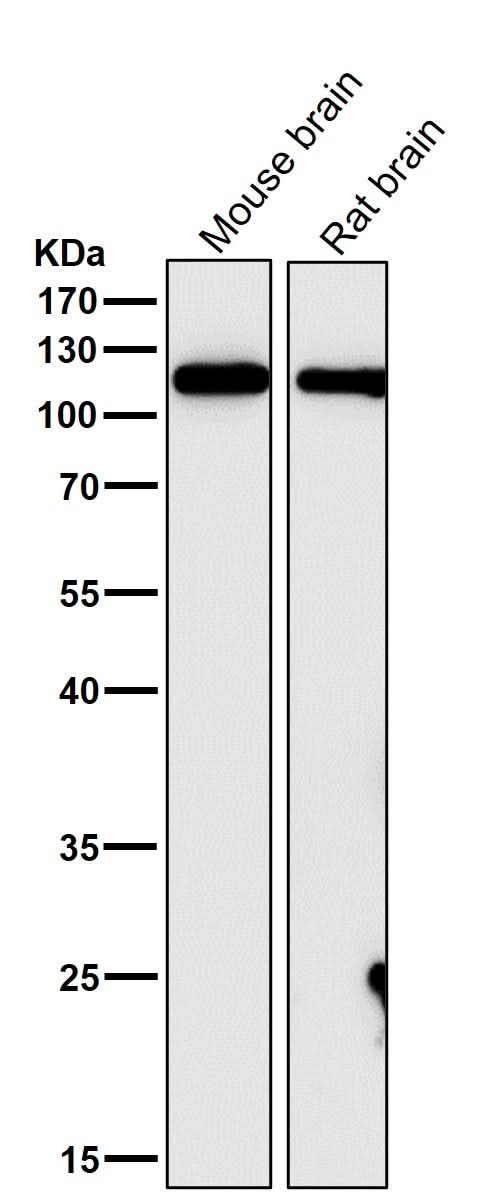 Anti-GEF H1 Rabbit Monoclonal Antibody Boster Bio