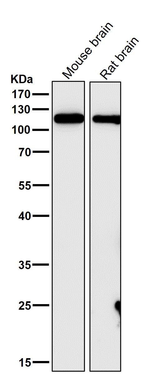 Anti-GEF H1 Rabbit Monoclonal Antibody Boster Bio