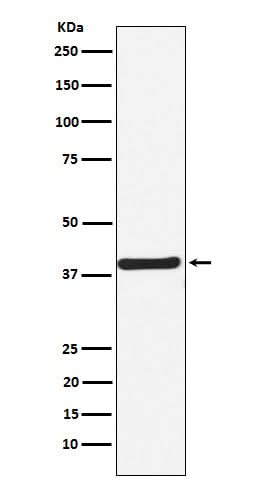 Anti-CaMKI Rabbit Monoclonal Antibody Boster Bio