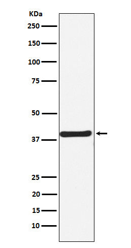 Anti-CaMKI Rabbit Monoclonal Antibody Boster Bio