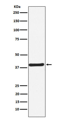 Anti-CaMKI Rabbit Monoclonal Antibody Boster Bio