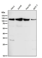 Anti-MCM3 Monoclonal Antibody Boster Bio