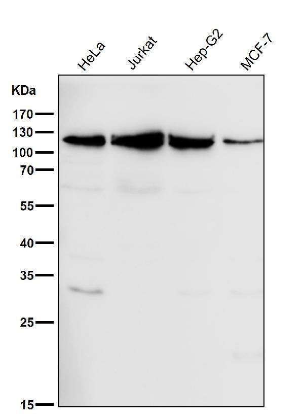 Anti-MCM3 Monoclonal Antibody Boster Bio